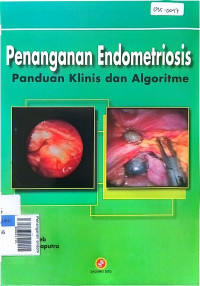 Penanganan endometriosis