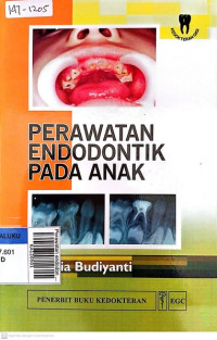 Perawatan endodontik pada anak