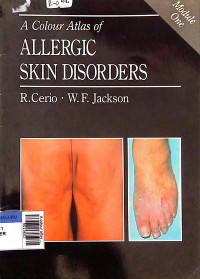 A colour atlas of allergic skin disorders